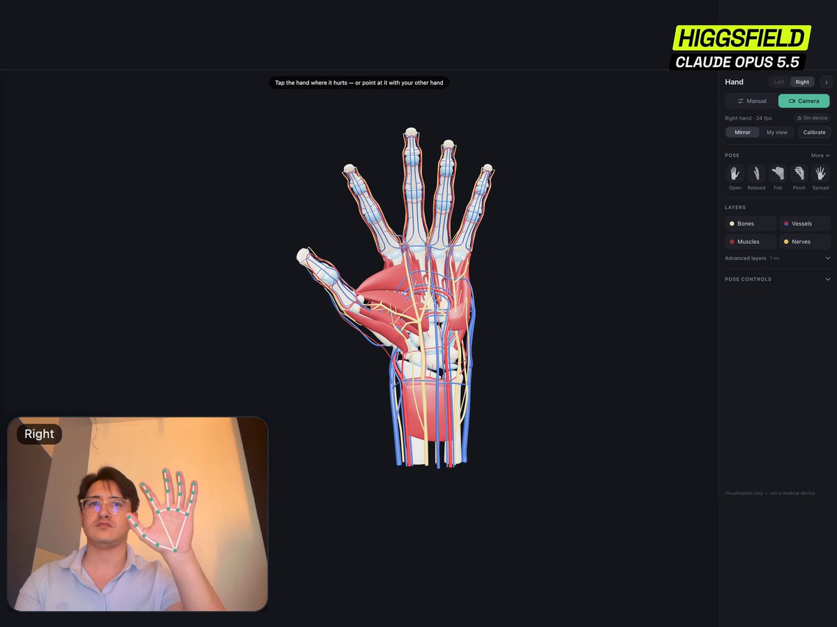 Higgsfield 用 Opus 5.5 生成可交互 3D 手部解剖模型