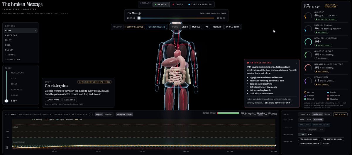 Opus 5.5 visualizes Type 1 diabetes in a single HTML file